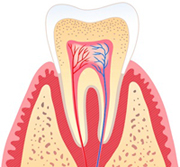 dentina nervio 180×167